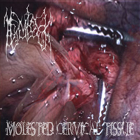 Hemlock (Mlt) - Molested Cervical Tissue (Demo)